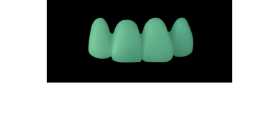 Cod.C22Facing : 15x  wax facings-bridges,  MEDIUM, Tapering ovoid, Aligned, TOOTH 12-22, compatible with Cod.A22Lingual,TOOTH 12-22 for long-term provisionals preparation